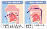 経鼻内視鏡検査について